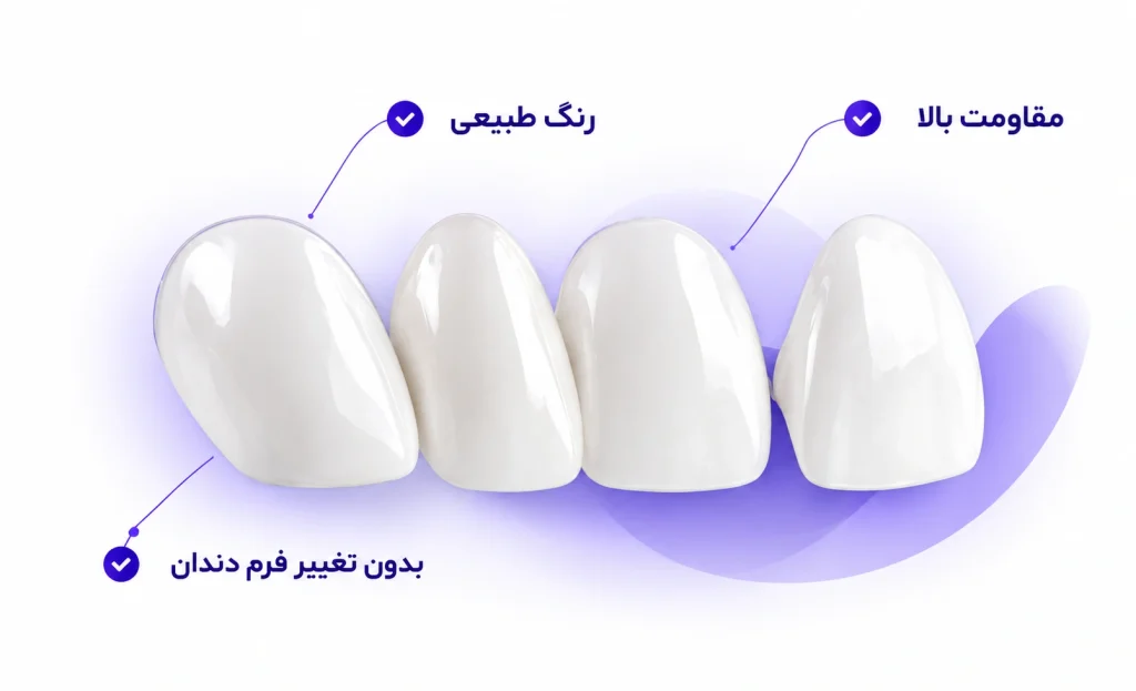 لمینت دندان چیست ؟